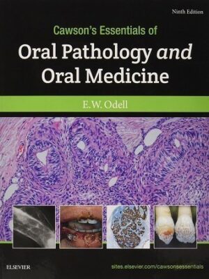 Cawson’s Essentials of Oral Pathology and Oral Medicine 9th Edition