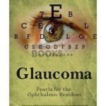 Glaucoma Pearls for the Ophthalmic Resident