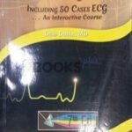 Rapid Interpretation of EKGs