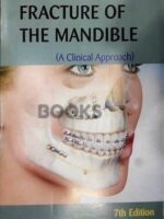 Killeys Fracture of the Mandible