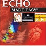 Echo Made Easy