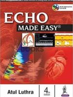 Echo Made Easy
