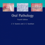 Soames & Southams Oral Pathology 4th Edition