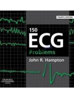150 ECG Problems 4th Edition