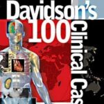 Davidson’s 100 Clinical Cases
