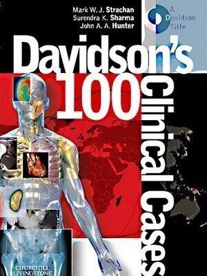 Davidson’s 100 Clinical Cases