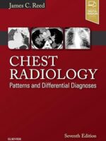 Chest Radiology: Patterns and Differential Diagnoses Hardcover – 15 December 2017