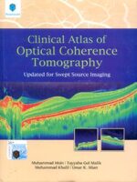 Clinical Atlas of Optical Coherence Tomography