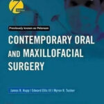 Contemporary Oral and Maxillofacial Surgery 7th Edition