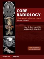 Core Radiology 2nd Edition