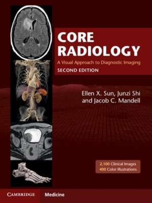 Core Radiology 2nd Edition