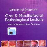 Differential Diagnosis of Oral and Maxillofacial Pathological Lesions