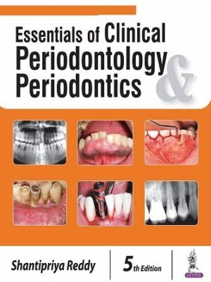 Essentials of Clinical Periodontology & Periodontics 5th Edition
