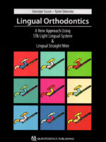 Lingual Orthodontics A New Approach Using Stb Light Lingual System & Lingual Straight Wire