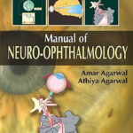 Manual of Neuro Ophthalmogy