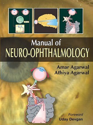 Manual of Neuro Ophthalmogy
