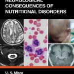 Neurological Consequences of Nutritional Disorders