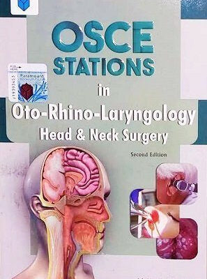 OSCE Stations in Oto Rhino Laryngology ENT 2nd Edition