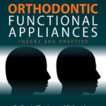 Orthodontic Functional Appliances Theory and Practice