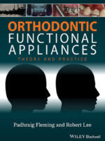 Orthodontic Functional Appliances Theory and Practice