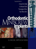 Orthodontic Miniscrew Implants Clinical Applications