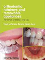 Orthodontic Retainers And Removable Appliances Principles Of Design And Use
