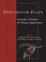 Perforator Flaps: Anatomy, Technique, & Clinical Applications 1st Edition, Kindle Edition