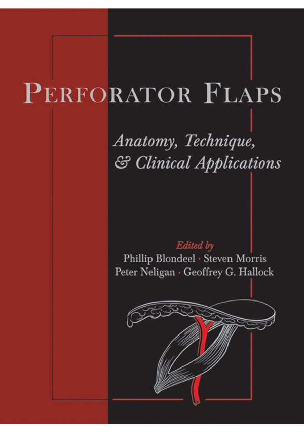 Perforator Flaps: Anatomy, Technique, & Clinical Applications 1st Edition, Kindle Edition
