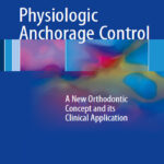 Physiologic Anchorage Control A New Orthodontic Concept and its Clinical Application