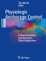 Physiologic Anchorage Control A New Orthodontic Concept and its Clinical Application
