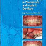 Practical Osseous Surgery in Periodontics and Implant Dentistry 1st Edition