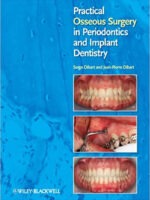 Practical Osseous Surgery in Periodontics and Implant Dentistry 1st Edition