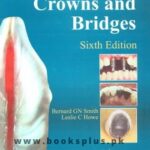 Smiths Planning and Making Crown and Bridges