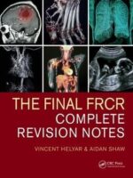The Final FRCR Complete Revision Notes